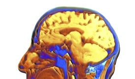 mri scan of human brain on porn