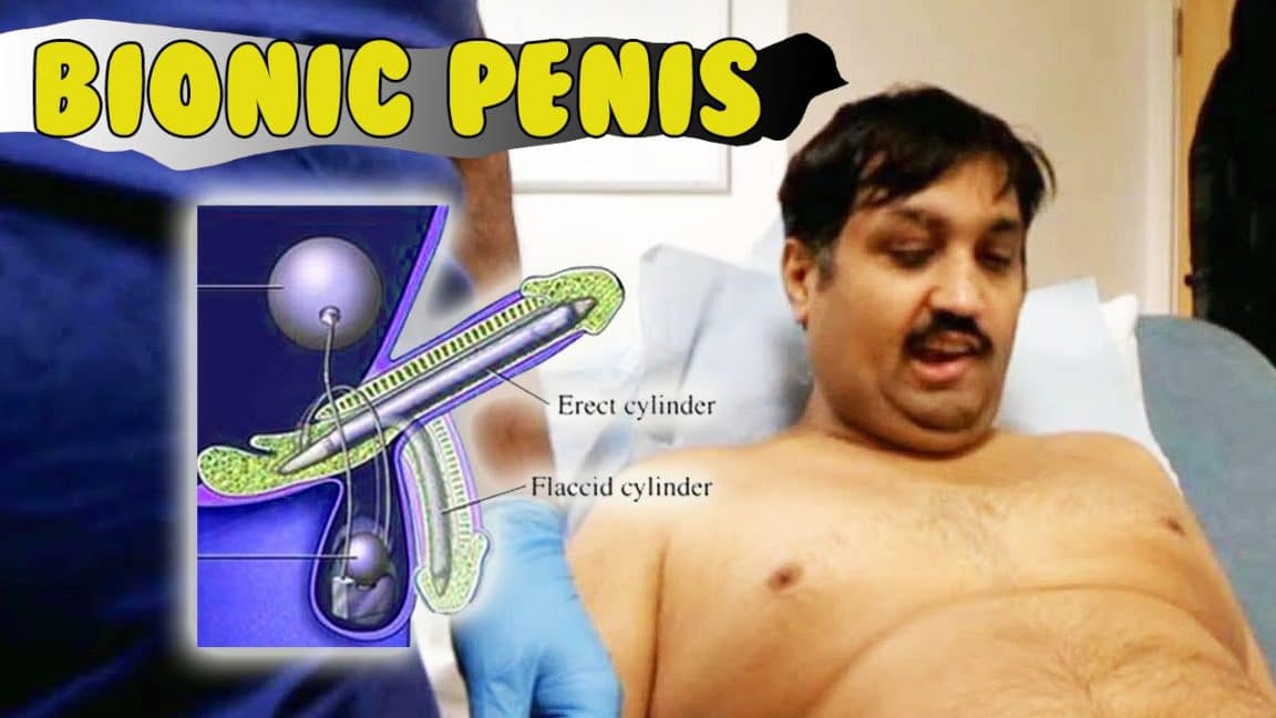 bionic penis